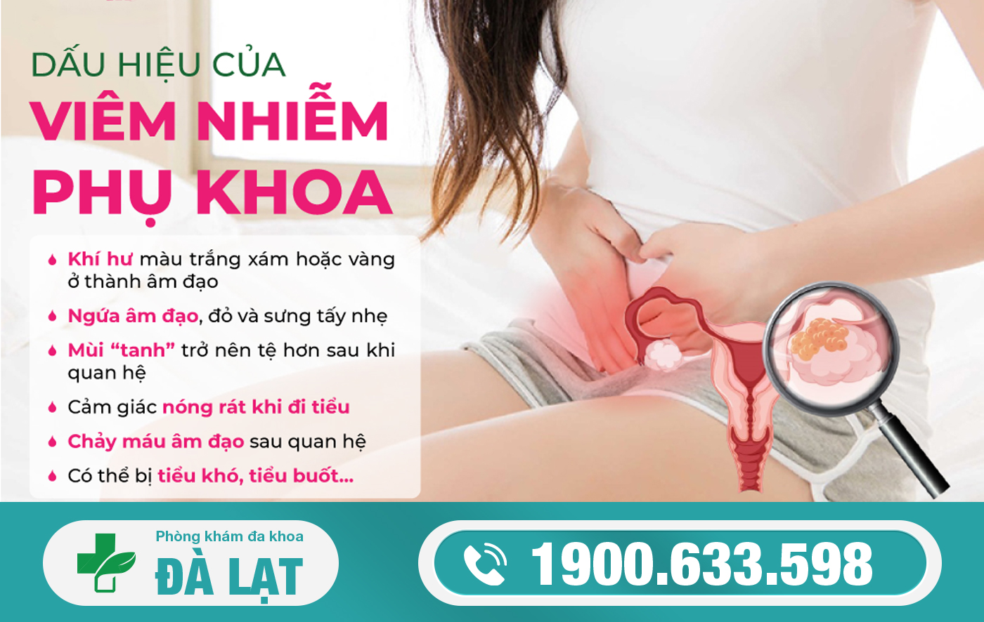 Hình ảnh minh họa